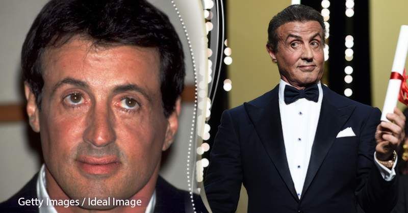 La cara de Sylvester Stallone ha sofert una greu transformació i els experts van confirmar les sospites dels fans