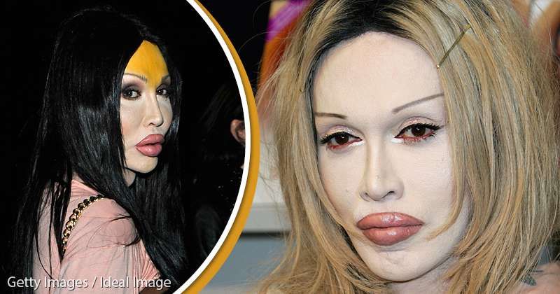 Nightmare Of The 'Living Ken': Pete Burns And His Changing Appearance