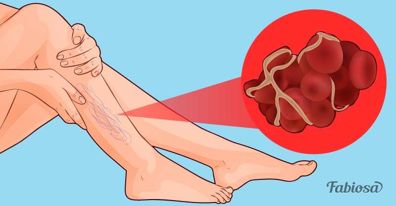 8 намирница које вам природно разређују крв и могу помоћи у спречавању проблема са срцем и судовима