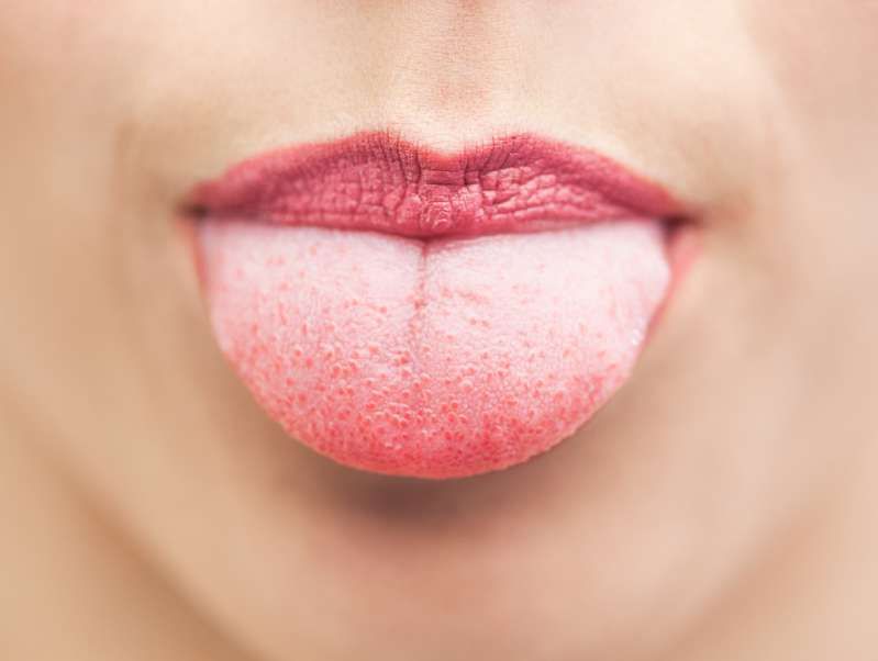 혀의 치아 자국은 언제 건강 문제를 나타내는가?