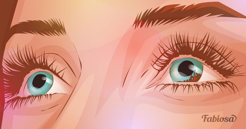 6 signes avant-coureurs du mélanome oculaire: qui risque de le contracter et comment le traiter
