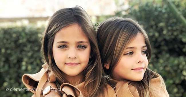 Ifølge eksperter kan Leah Rose og Ava Marie Clements bli de vakreste tvillingjentene i verden