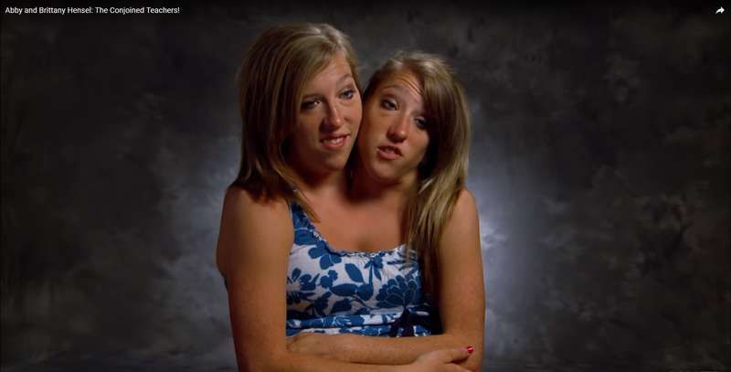 결합 된 쌍둥이 Abby와 Brittany Hensel은 종류 중 하나입니다. 그들이 지금 어디에 있는지보기