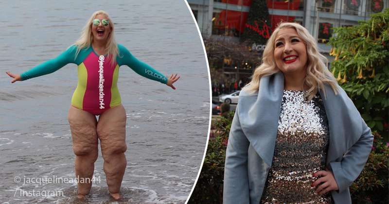 'Ells no em coneixen': la dona que va perdre 350 lliures comparteix com li va fer vergonya per la pell solta